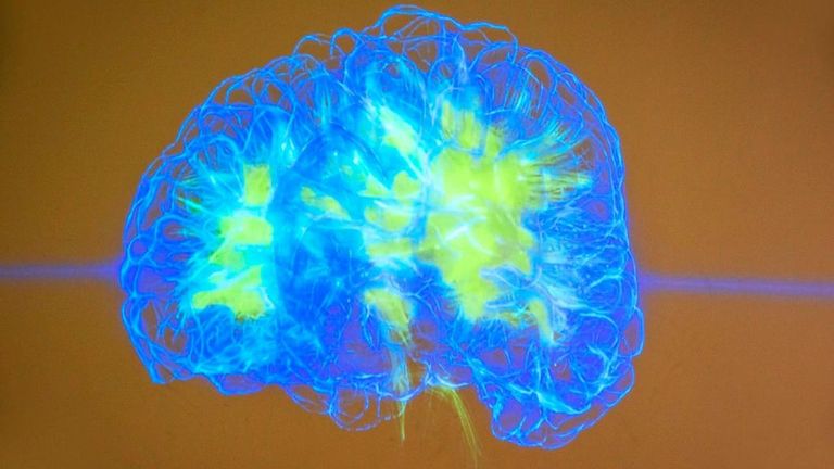 Can AI learn and evolve like a brain? Pathway's bold research thinks so